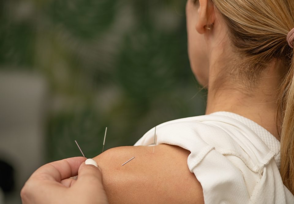 improve mood with acupuncture بهبود خلق و خو
