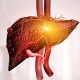 fatty liver Treatment درمان کبد چرب
