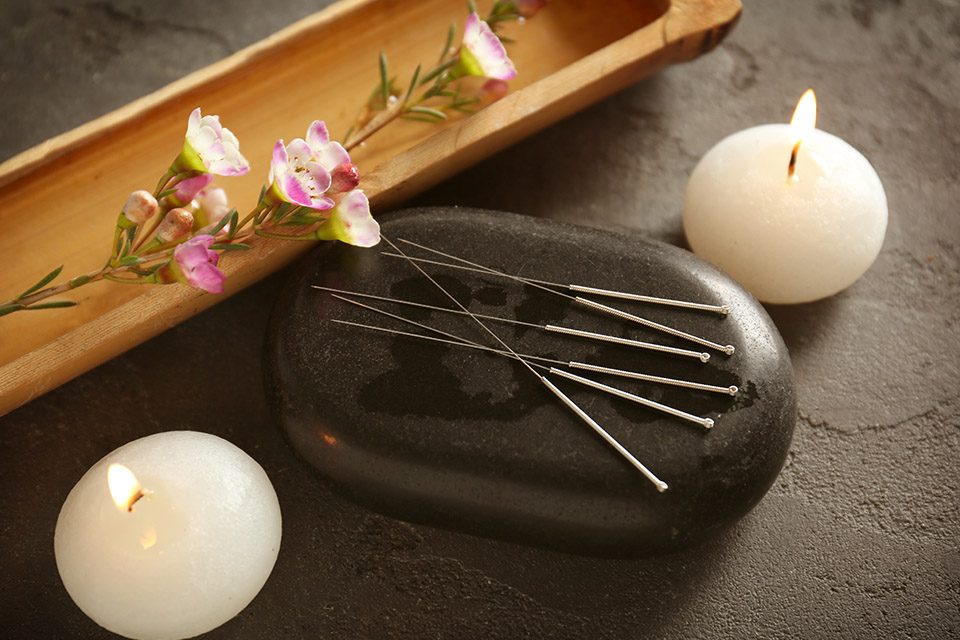 acupuncture importance traditional treatment اهمیت طب سوزنی