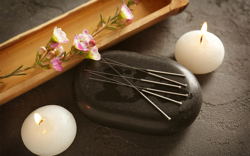 acupuncture importance traditional treatment اهمیت طب سوزنی