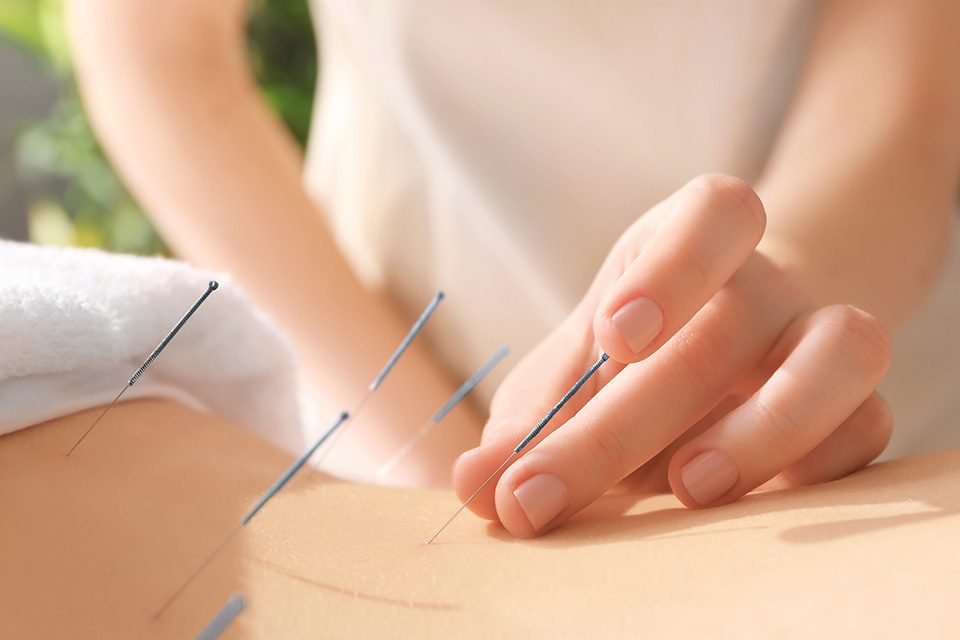 Treatment of infertility with acupuncture درمان نازایی با طب سوزنی