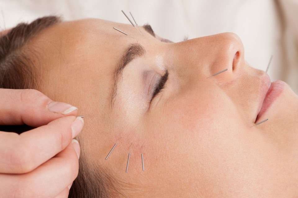 Facial beauty and skin rejuvenation with acupuncture زیبایی صورت و جوانسازی پوست با طب سوزنی