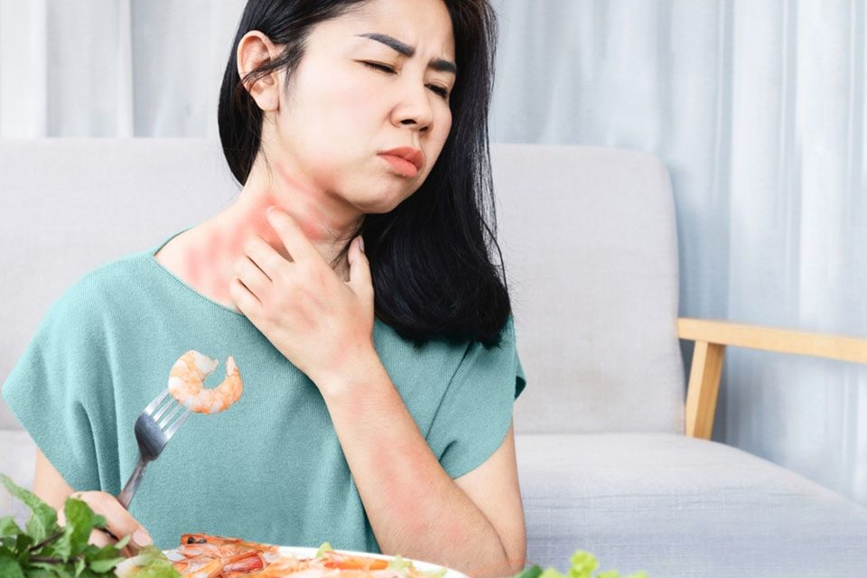 food allergy حساسیت غذایی