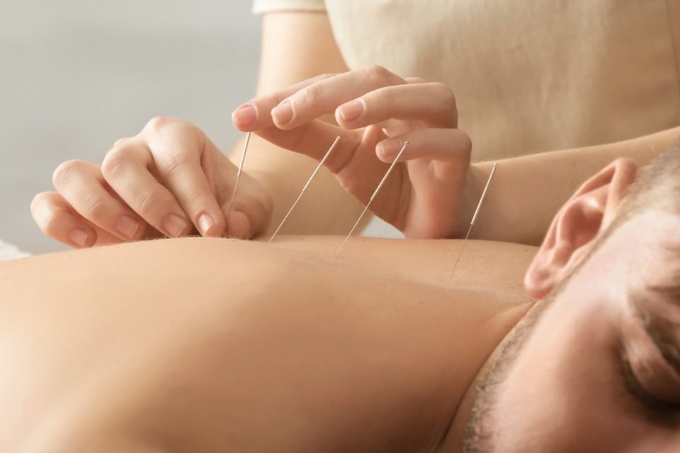 body detox acupuncture پاکسازی بدن طب سوزنی