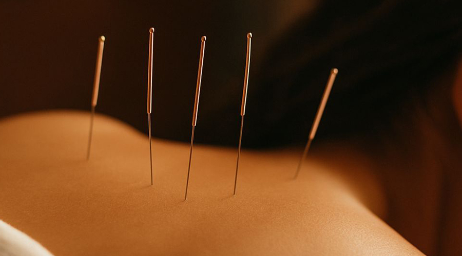 طب سوزنی و سیستم ایمنی