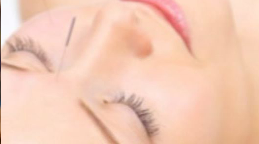 طب سوزنی برای استرس و اضطراب