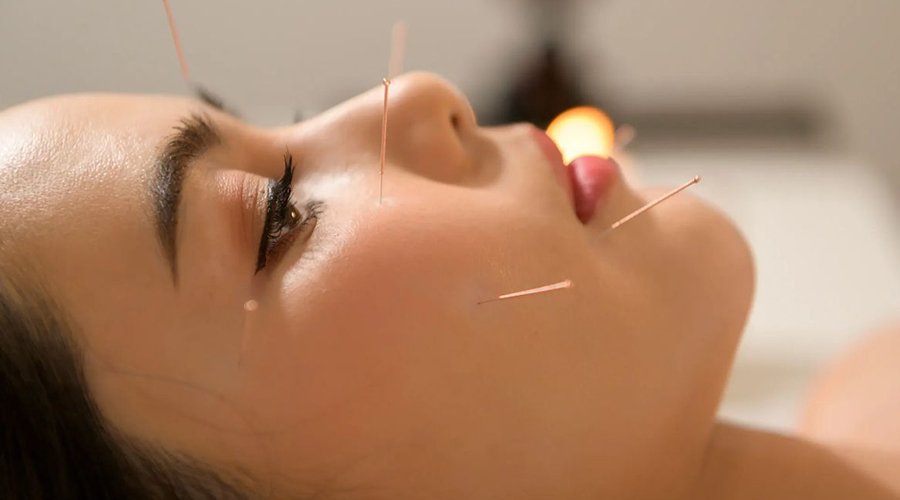 acupuncture-for-allergy-treatment