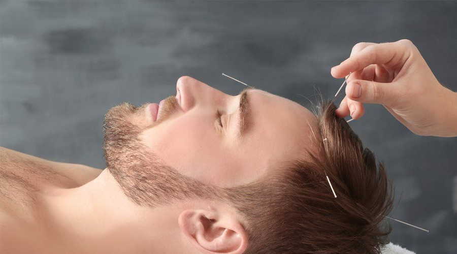acupuncture-for-insomnia-treatment